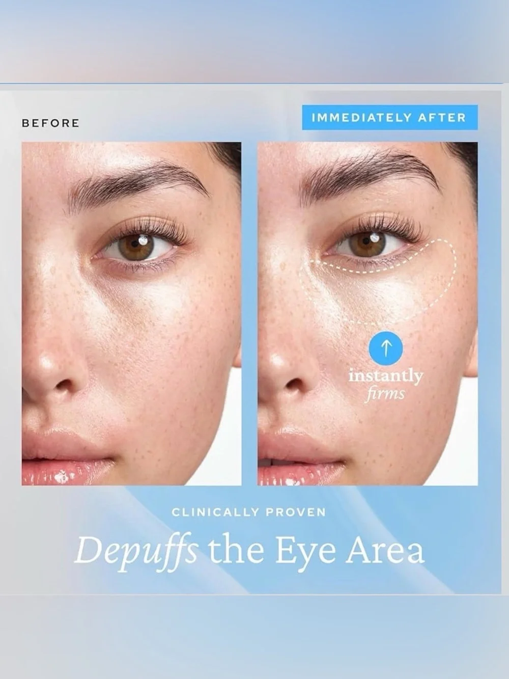 Belif Aqua Bomb Eye Gel